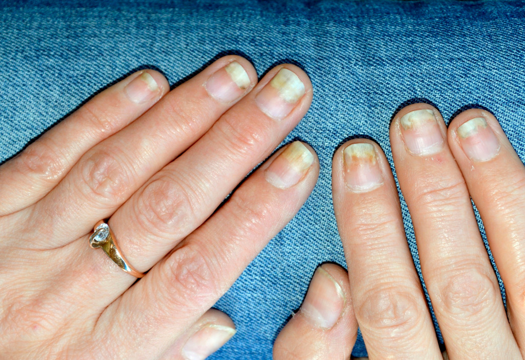Jak bezpiecznie usunąć hybrydę z paznokci?
